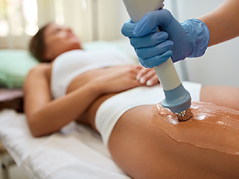 cellulite-acoustic-wave-therapy-0001